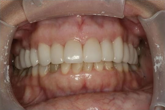 smile gallery image