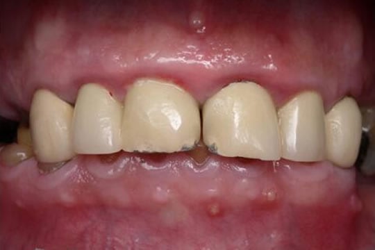 smile gallery image