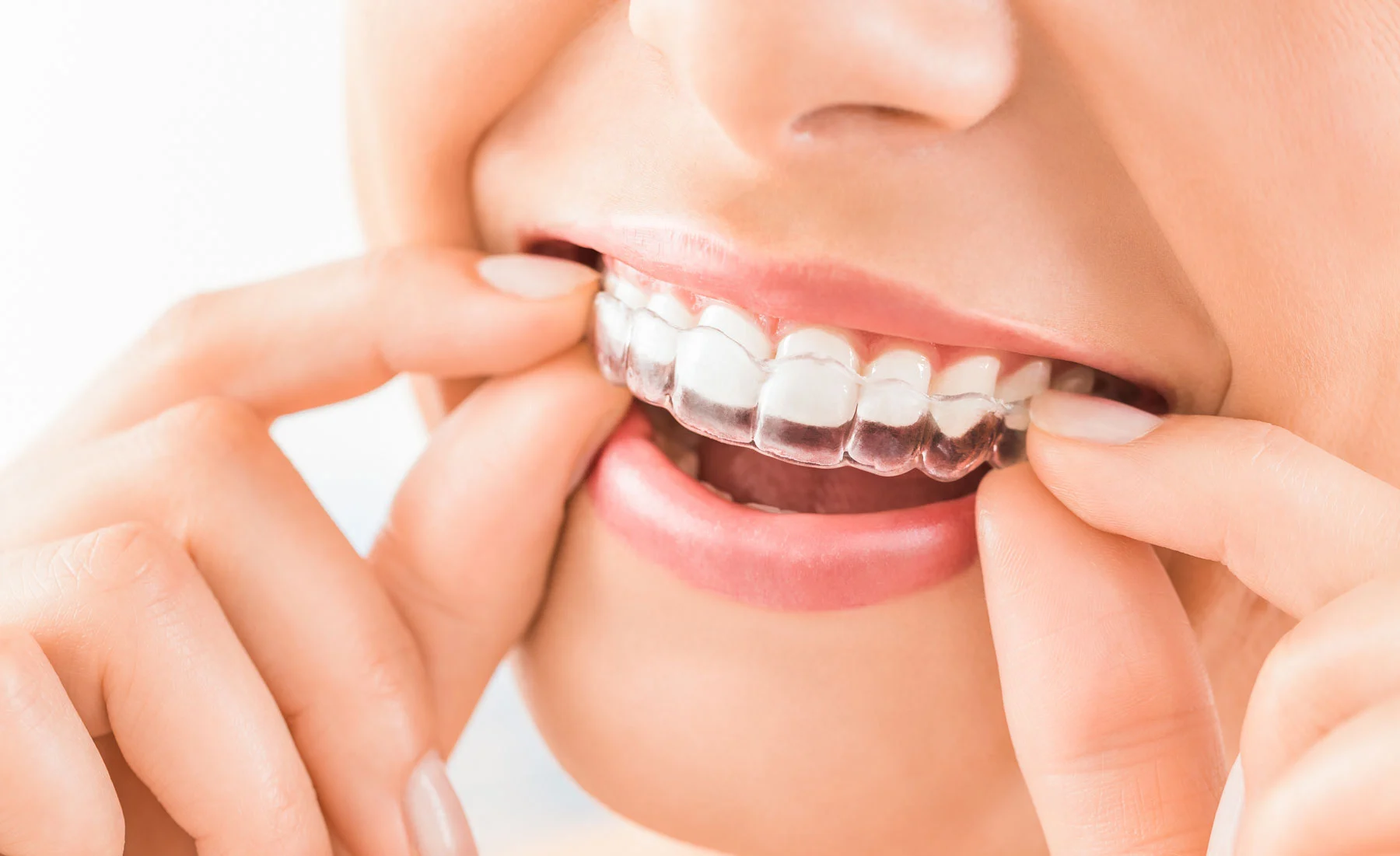 considering online dental products