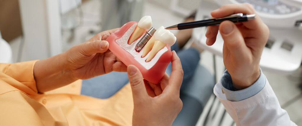 dentures vs implants full arch restoration