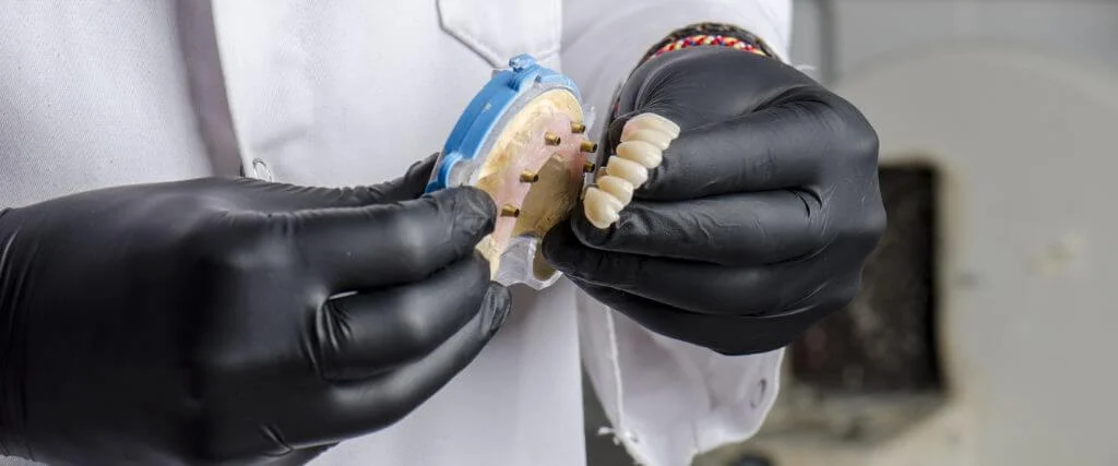 implant supported dentures