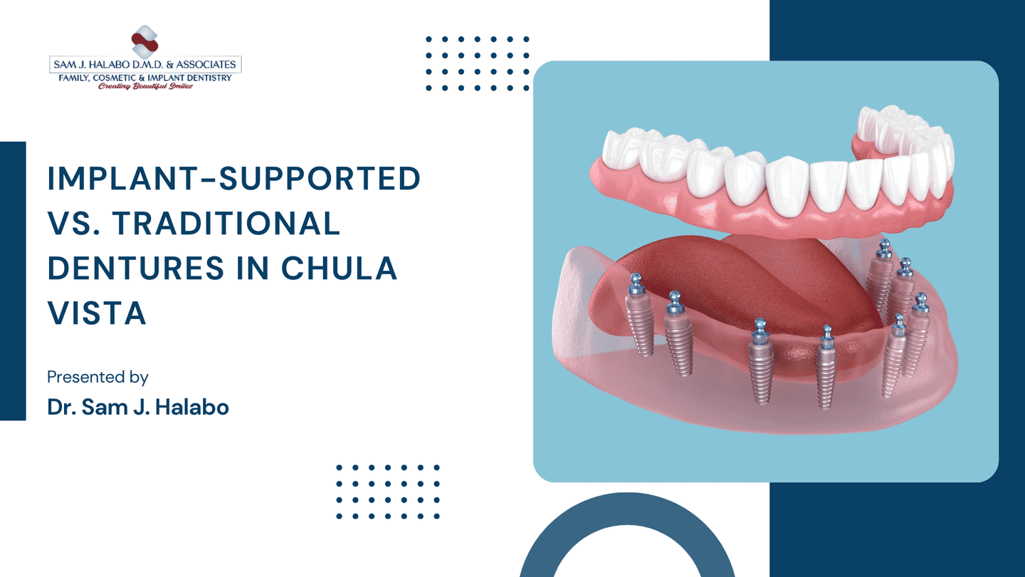 Implant-Supported vs. Traditional Dentures in Chula Vista